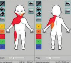 Seminario Quemados, Sociedad Latinoamericana de Cuidados Intensivos Pediátricos